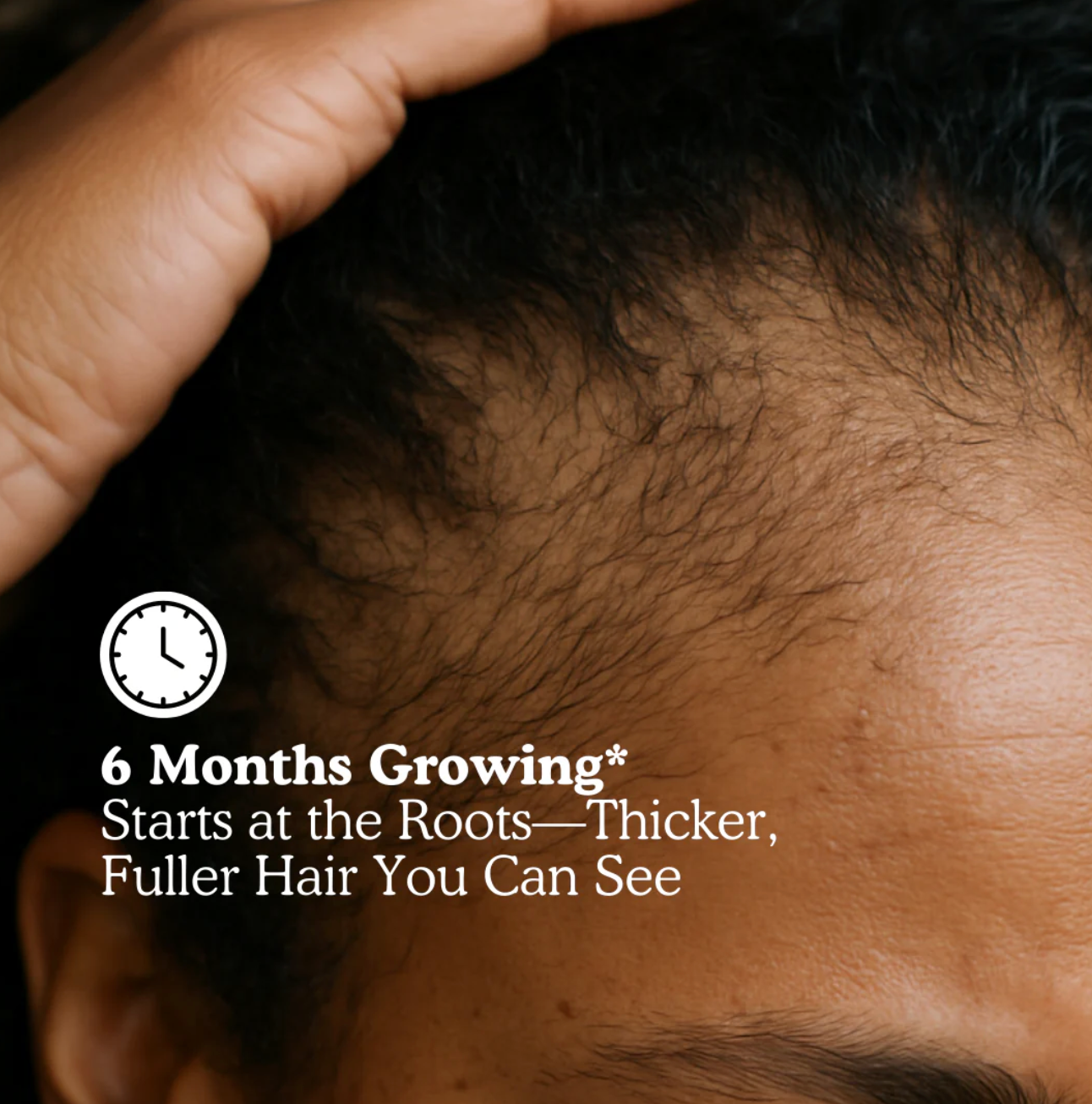 LOOMARIE - RRB Hair Growth Gummies