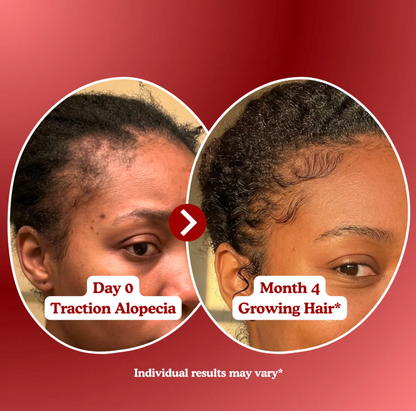 LOOMARIE - RRB Hair Growth Gummies