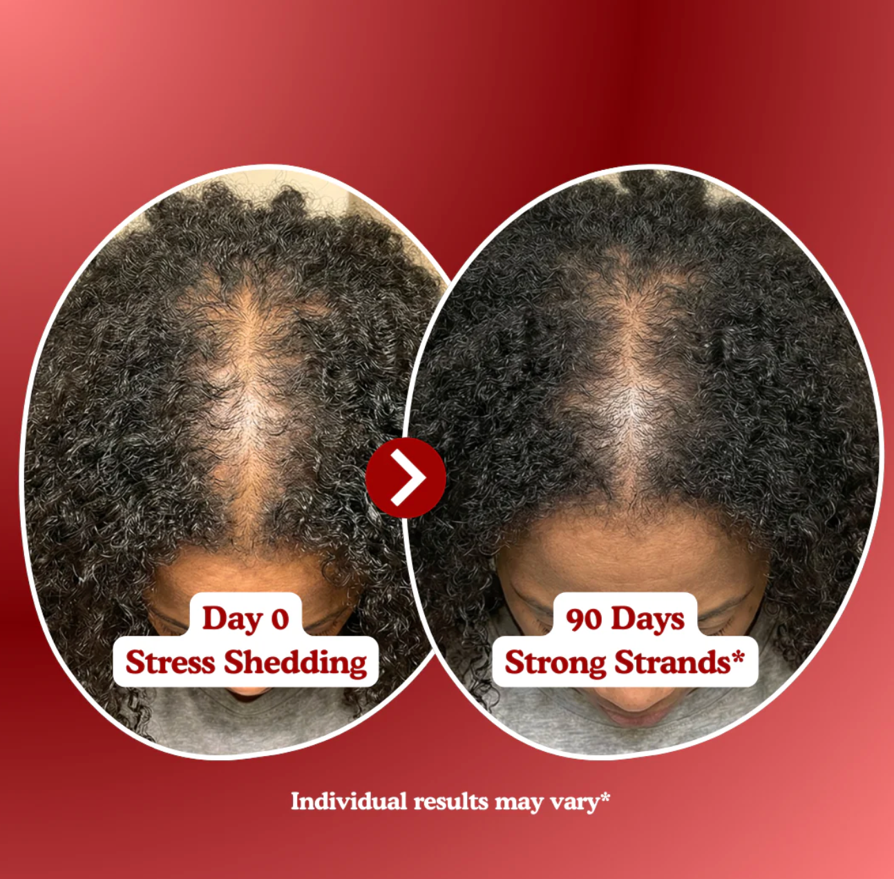 LOOMARIE - RRB Hair Growth Gummies