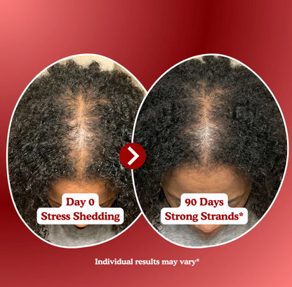 LOOMARIE - RRB Hair Growth Gummies