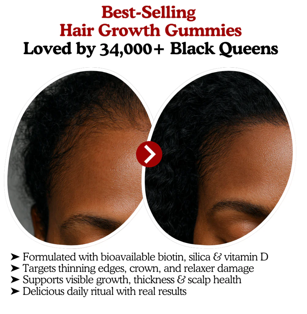 LOOMARIE - RRB Hair Growth Gummies