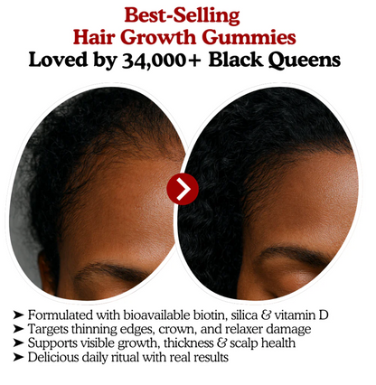 LOOMARIE - RRB Hair Growth Gummies